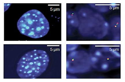 熒光原位雜交技術（Fluorescence in situ hybridization，FISH）
